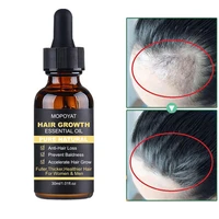 30ml effective hair growth essential oil repair damage hair growth treatment thick root repair dry anti hair loss essence