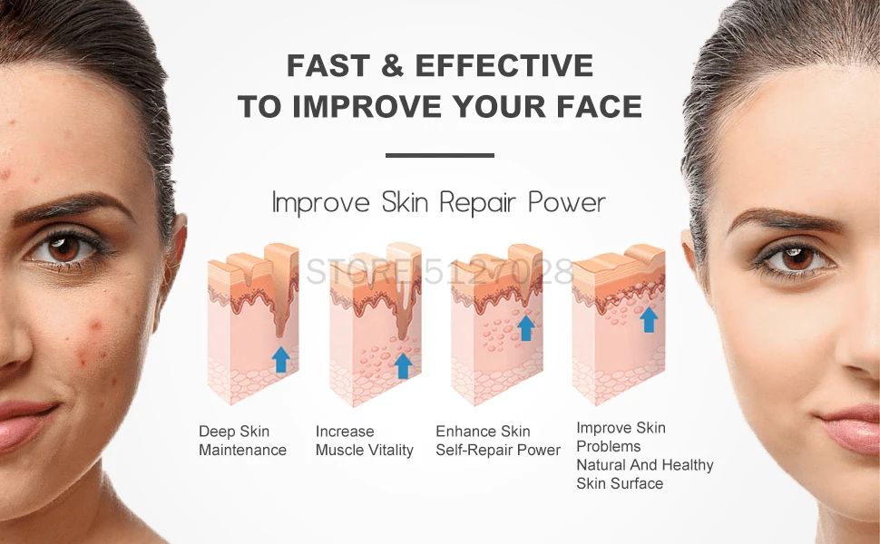 Стеклянный тюбик 4 в 1 Высокочастотный электрод для удаления пятен и прыщей на