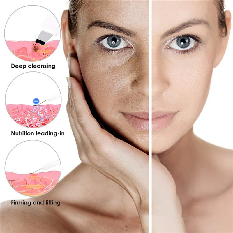 Ультразвуковой пилинг для лица глубокий аппарат чистки скруббер удаления грязи