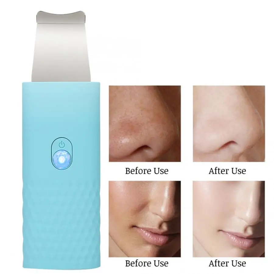 Портативное средство для очистки лица отшелушивания удаления черных точек акне