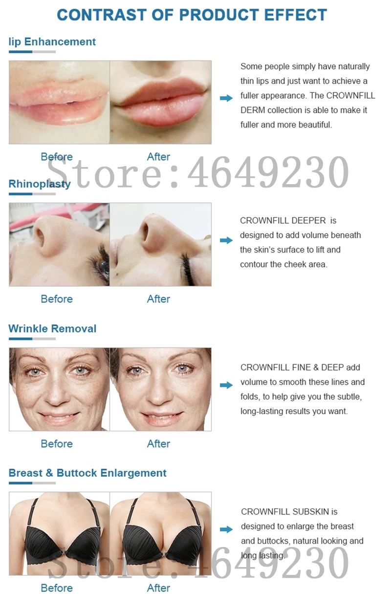 2in1 Meso Injection Gun Hyaluron Pen 0.3ml&0.5ml Head Gold Hyaluronique Acid Pen Lip Filler Jnjector Noninvasive Nebulizer New