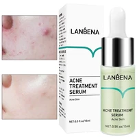 face serum removal acne reduce pox pit moisturing brighten skin tone deep nourishment mild repair improve face skin condition