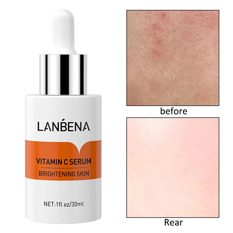 

4 стиля уход за кожей лица успокаивающий Сыворотки увлажняющий Collenage жидкости чувствительной кожи ремонт, для лечения прыщей, крем для лица ...