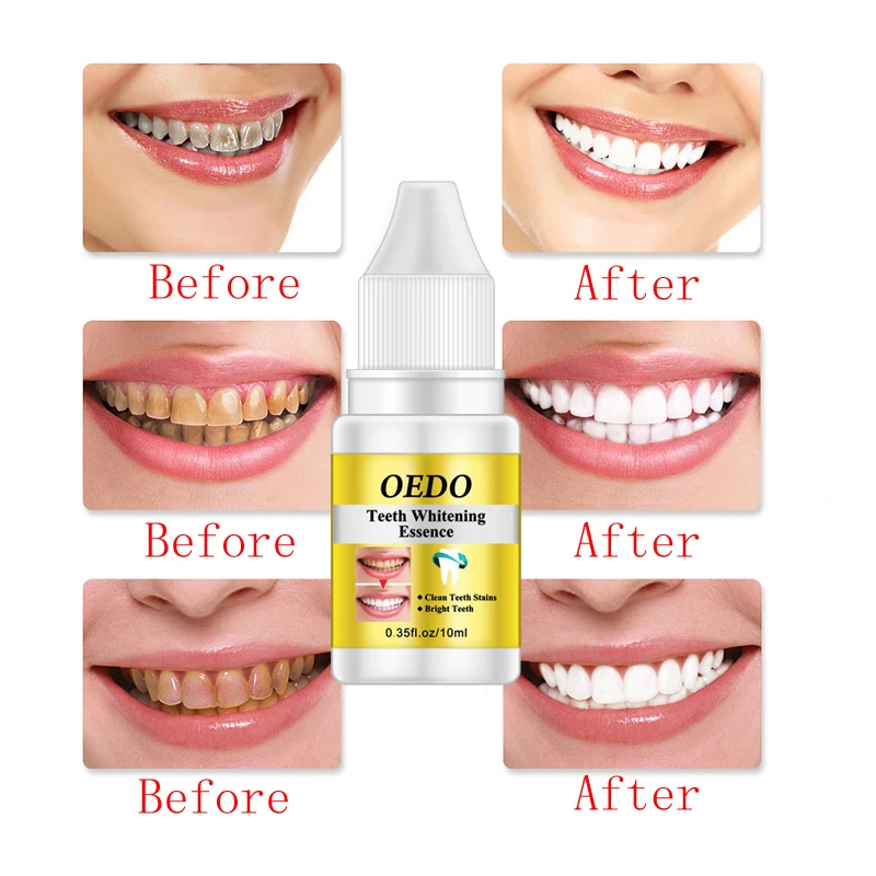 OEDO зубная паста отбеливание зубов пудра с эссенцией гигиены полости рта Чистящая