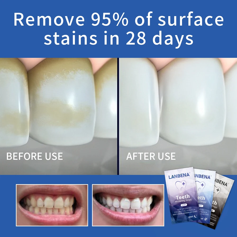 Виниры для отбеливания зубов LANBENA белая полоска удаления зубного налета порошок