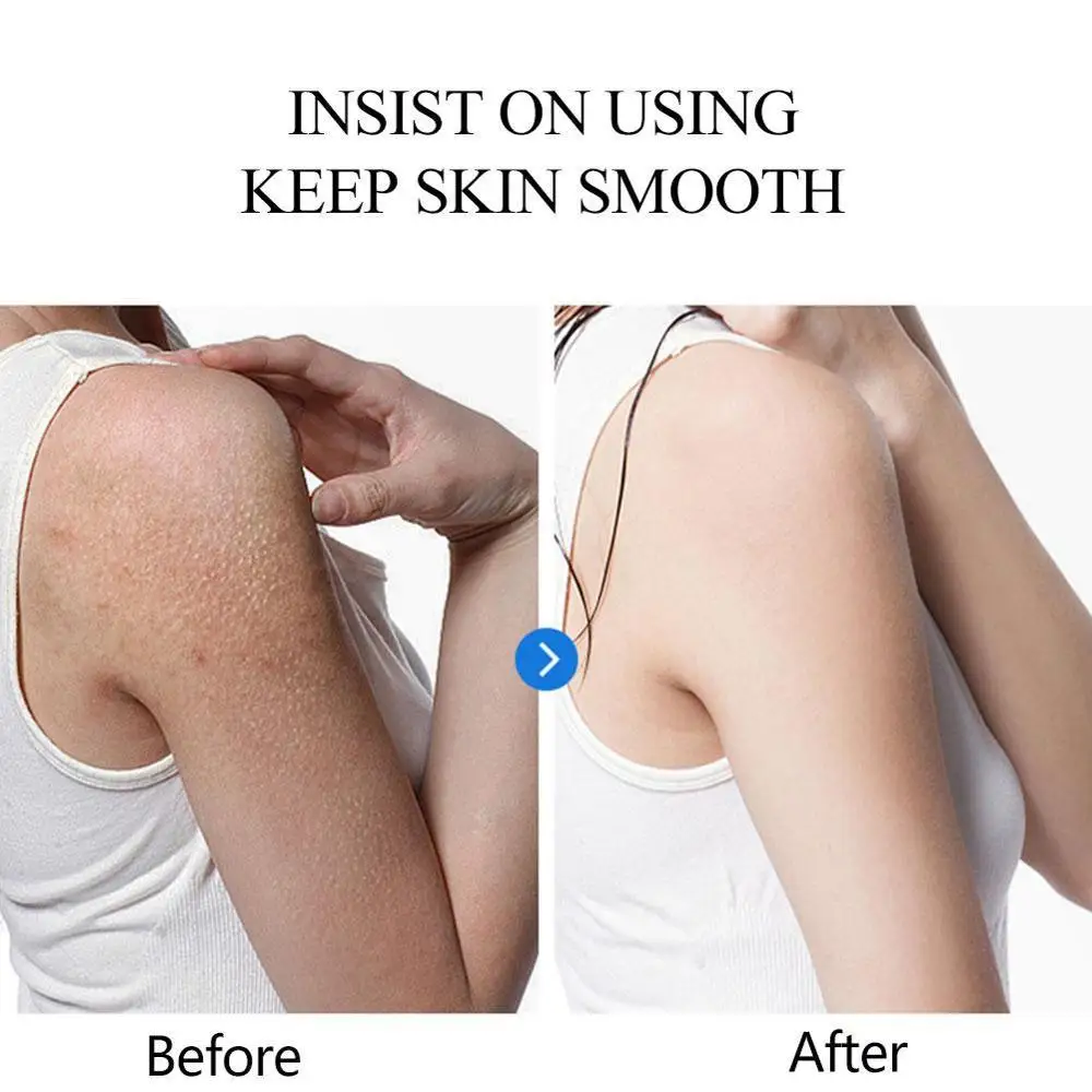 Чистое Натуральное эфирное масло 50 мл с экстрактом уксуса и гусиными бугорками