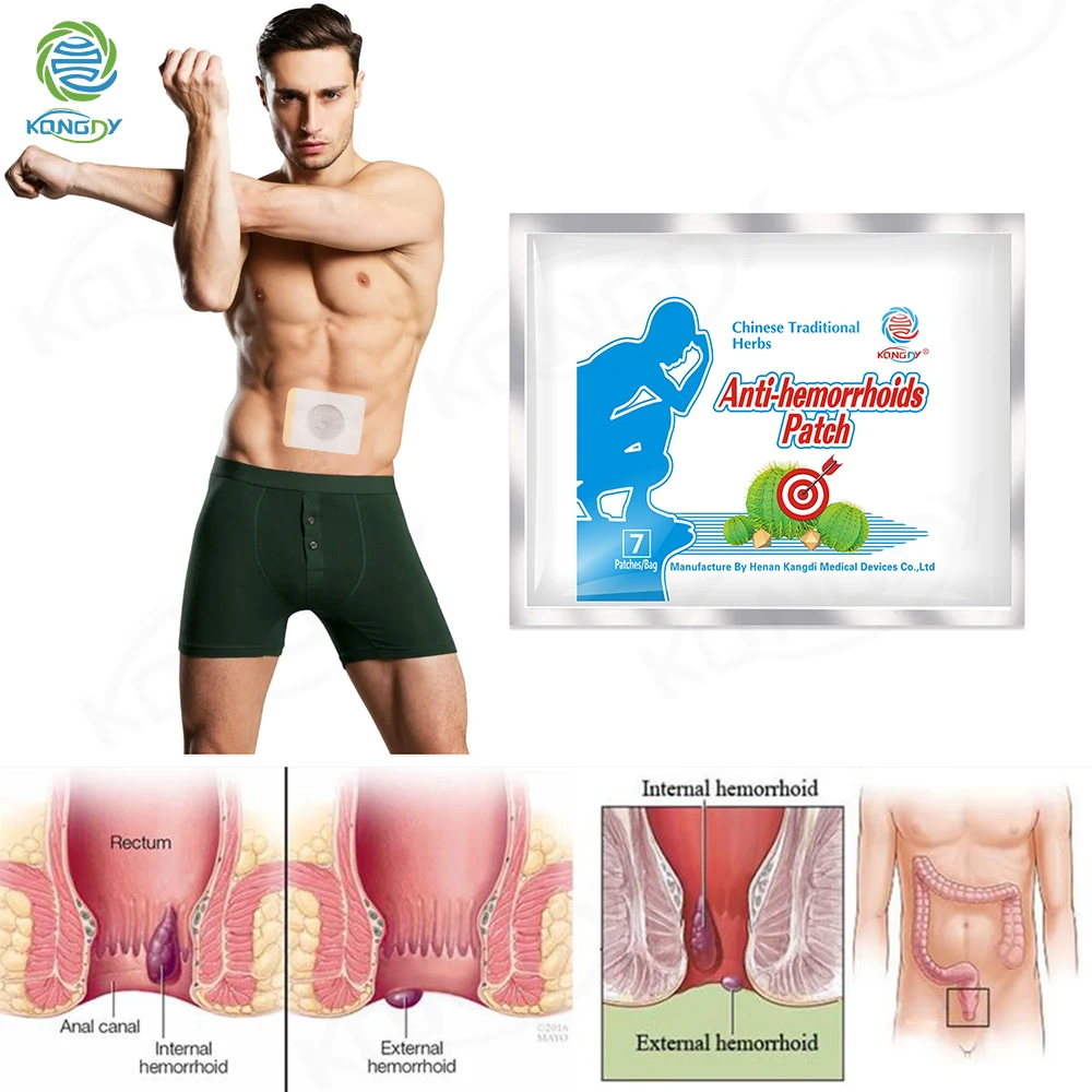 

7 Pieces Anti Hemorrhoid Patch Bleeding Anus Itching Patches Piles Anal Fissure Plaster Internal/External Hemorrhoids Therapy
