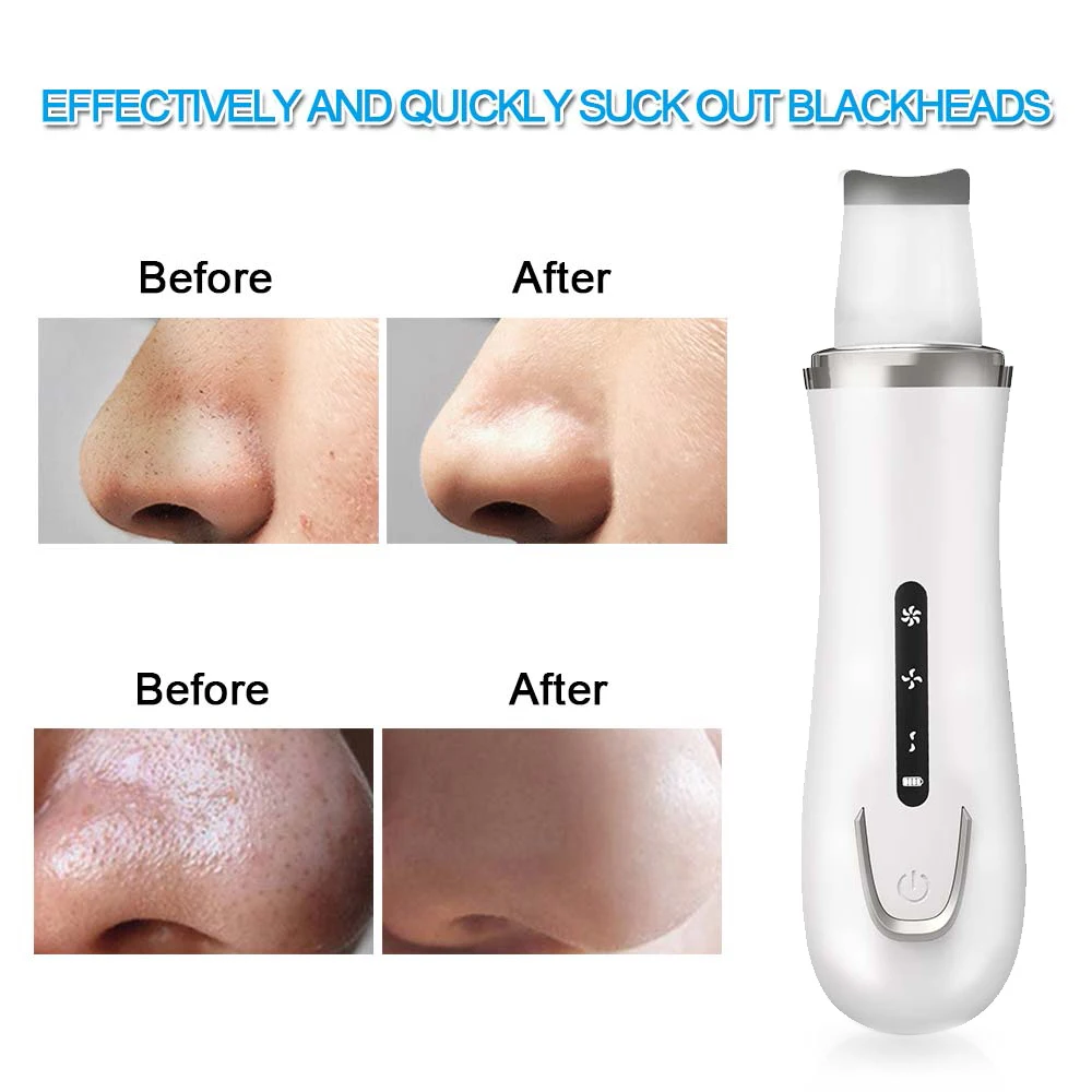 Facial Skin Scrubber Blackhead Remover Ultrasonic Face Deep Pore Acne Cleaner Spatula Face Lifting Whitening Massager Skin Care