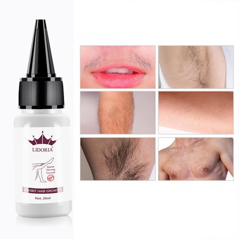 20 мл средство для удаления волос восстановления ингибирующее жидкость