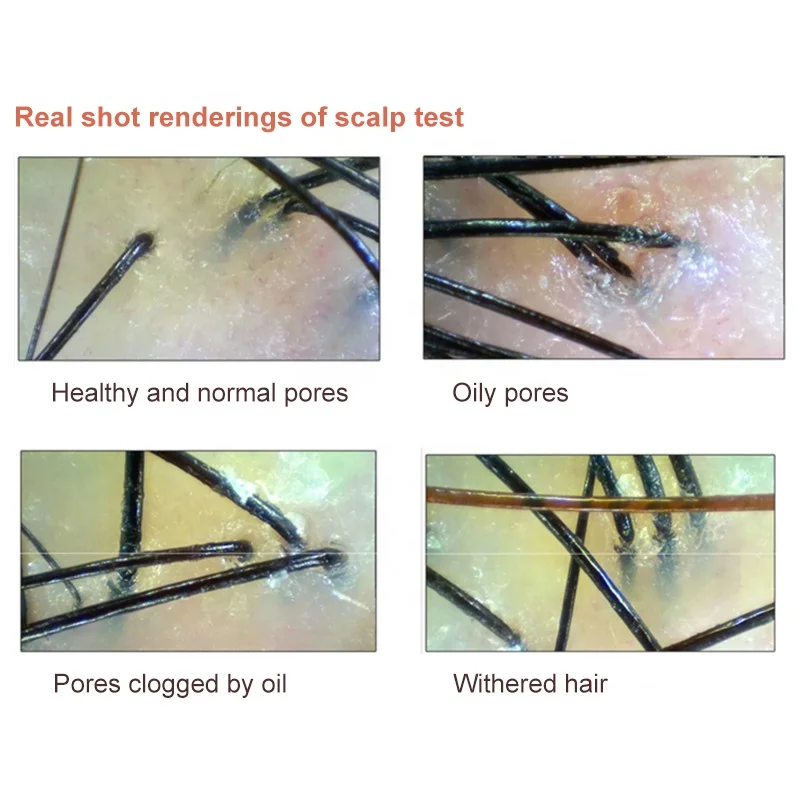 artificial intelligence portable facial skin analyzer facial detector system wireless wifi hd mobile phone tablet free global shipping