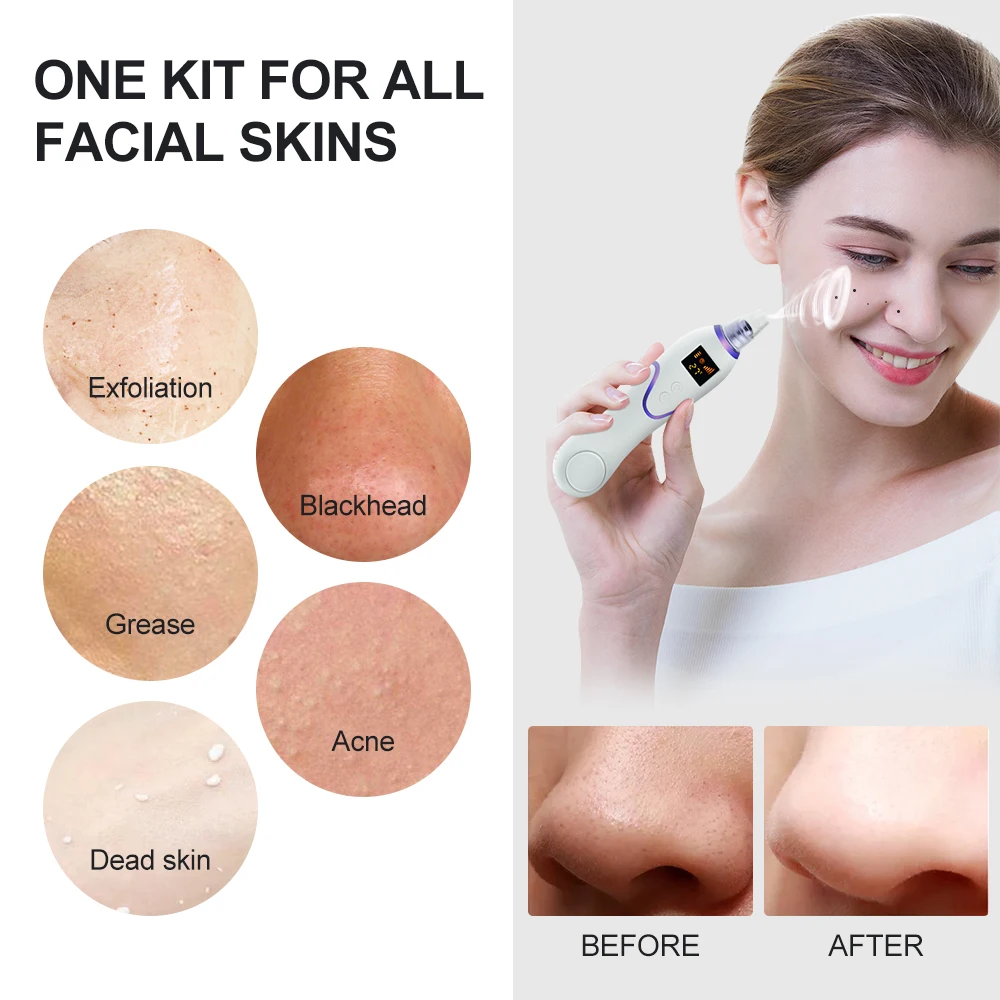 

Vacuum Blackhead Remover Skin Care Pore Acne Pimple Removal Vacuum Cleaner Black Dot Blackhead Removal Device Skin Care Tools