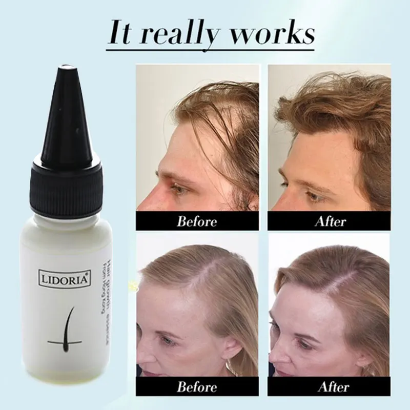 

Сыворотка для быстрого роста волос, 20 мл