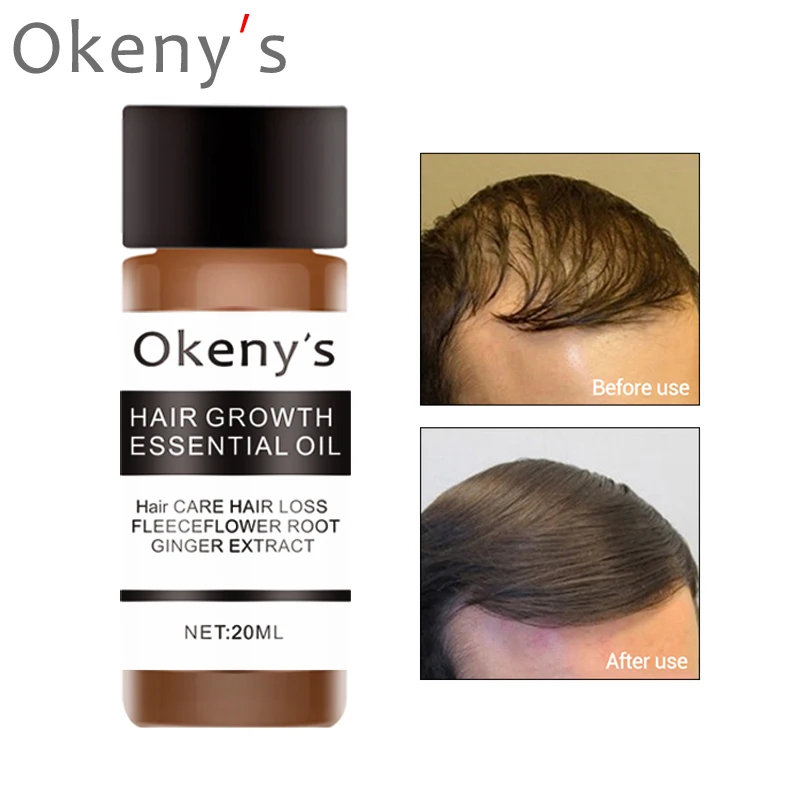 Okeny's быстрые мощные средства с эссенцией для рост волос Эфирное Масло жидкое