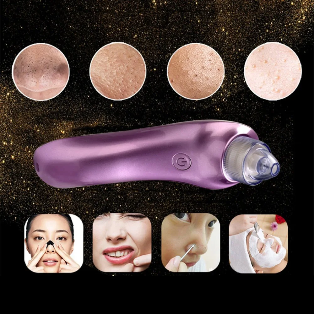 5 в USB зарядка вакуумный Электрический Очиститель пор для лица удаление угрей