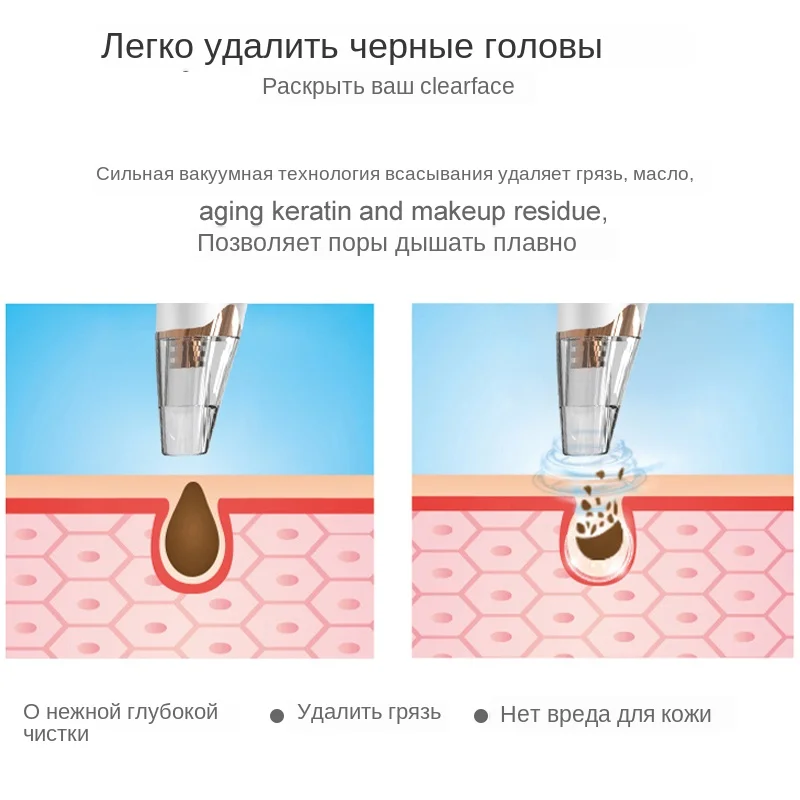 Средство для удаления угрей, уход за кожей, очиститель пор, вакуумное Удаление прыщей, инструмент для вакуумного всасывания, инструмент для ухода за кожей лица