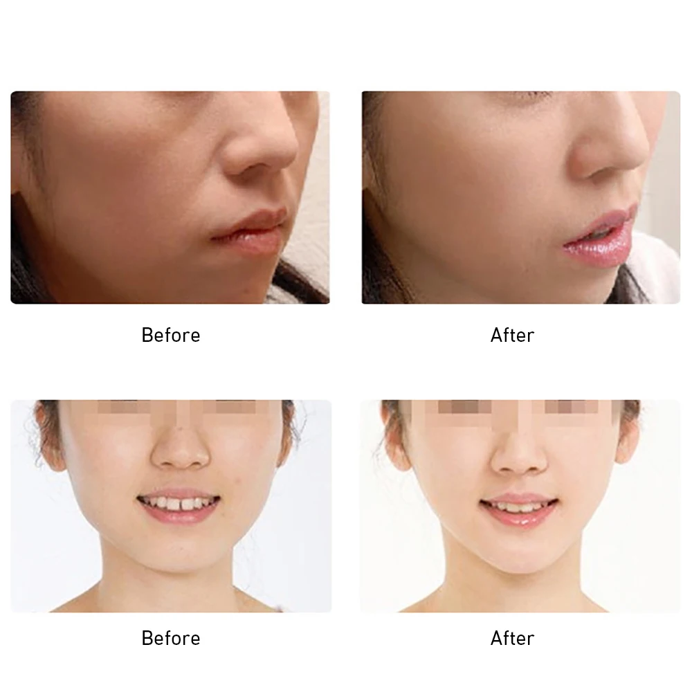 Микро-токовый тонкий инструмент для красоты лица лифтинг и подтягивание кожи