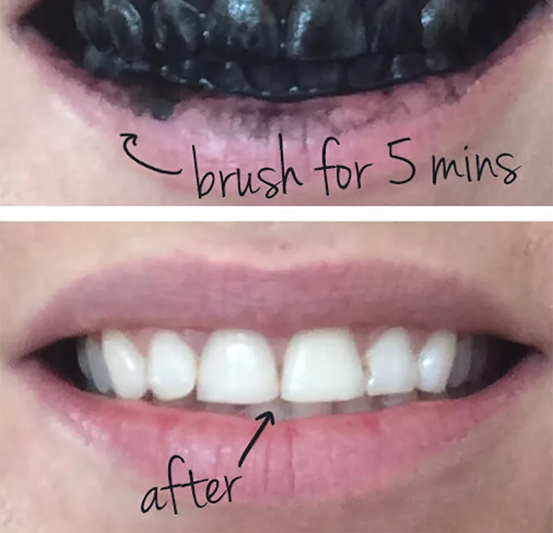 

1pc Teeth Whitening Scaling Powder Oral Hygiene Cleaning Packing Premium Activated Bamboo Charcoal Powder Removal Coffee Stains
