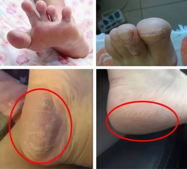 

Small green cream foot crack cream heel crack crack anti-stem dry hand and foot crack healing crack repair cream