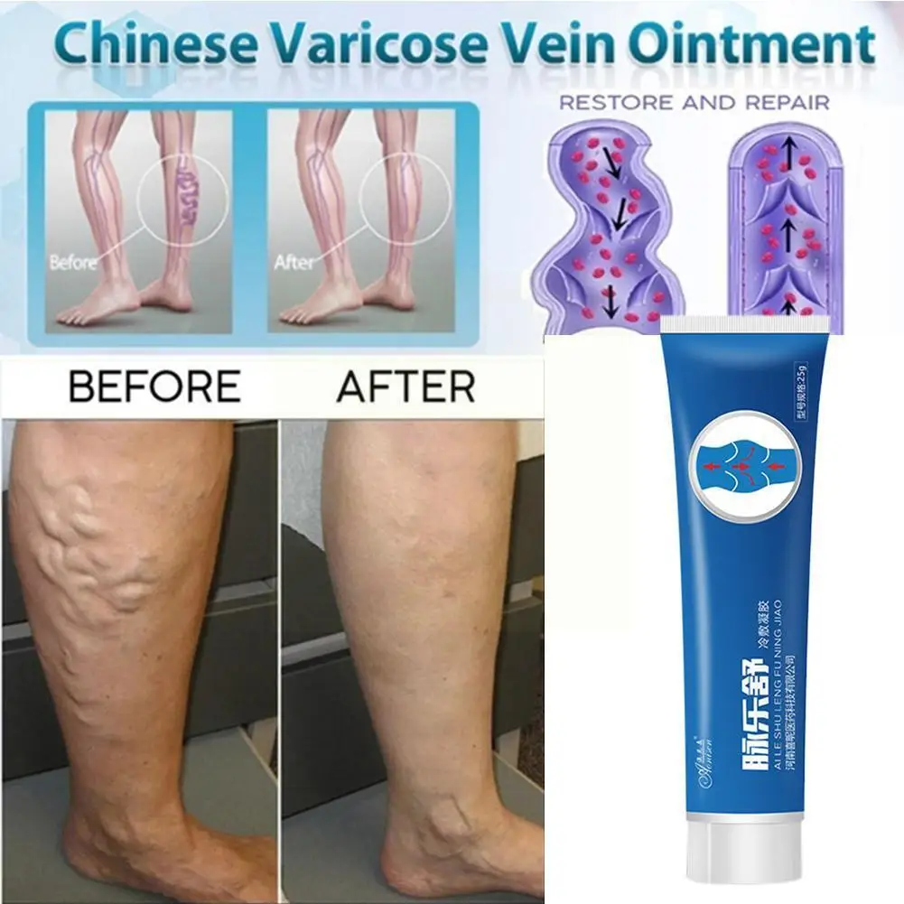 

Крем для варикозного расширения вен, 25 мл, S E4X9