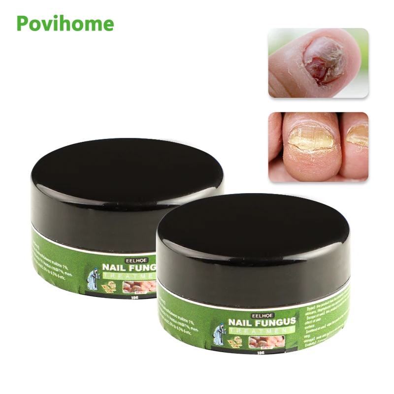 

1Pcs Toe Finger Nail Repair Treatment Oil Antibacterial Repair Ointment Whitening Anti Infection Fungal Nail Cream Health Care