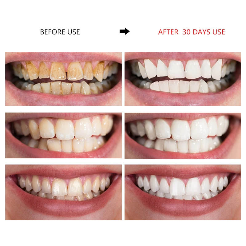 OMY LADY отбеливающий мусс для чистки зубов свежий Сияющий Зеленый Чай Зубная паста