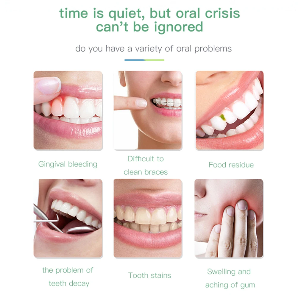 

Oral Irrigator USB Rechargeable Water Flosser Portable Dental Water Jet 300ML Water Tank Waterproof Teeth Cleaner
