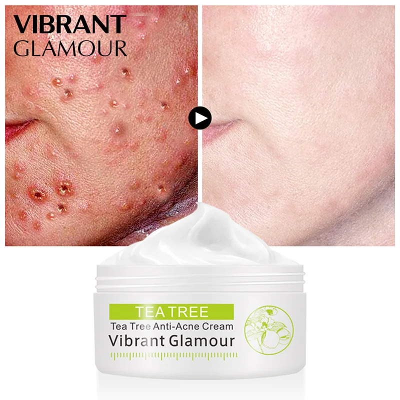 

VIBRANT GLAMOUR Tea Tree Anti-Acne Face Cream Oil Control Shrink Pores Remove Acne Cream Nourish Whitening Acne Scar Skin Care