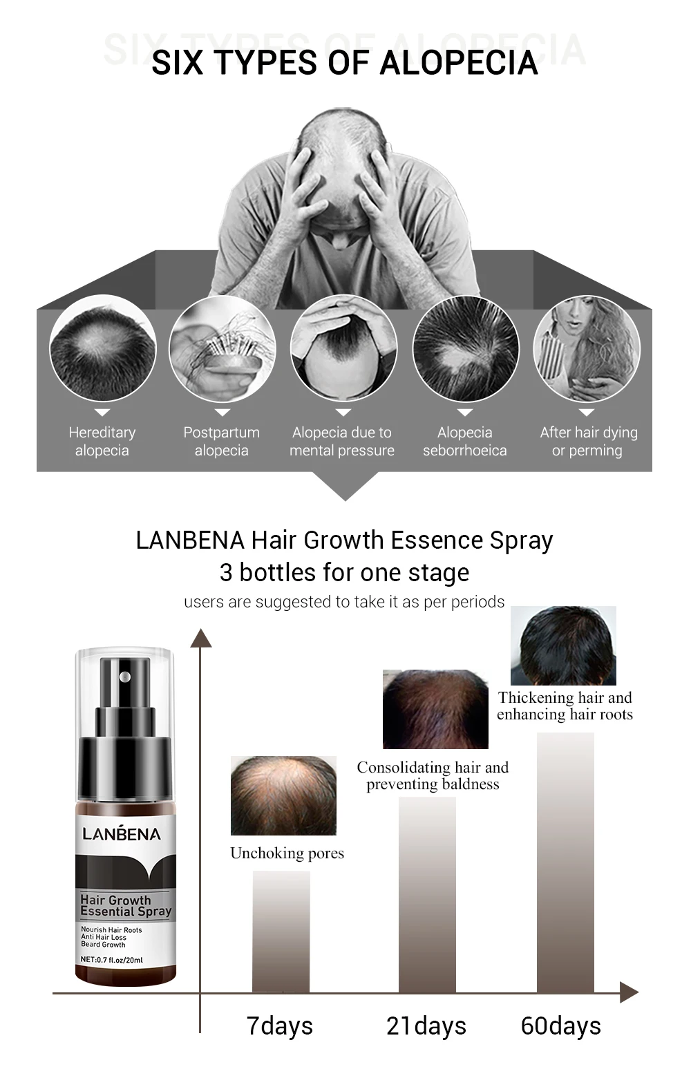 

LANBENA Hair Growth Essence Spray Product Preventing Baldness Consolidating Anti Hair Loss Nourish Roots Easy To Carry Hair Care