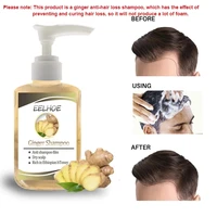 ginseng anti hair loss shampoo powerful treatment essence herbs ginger cooler hair growth lotions for men women