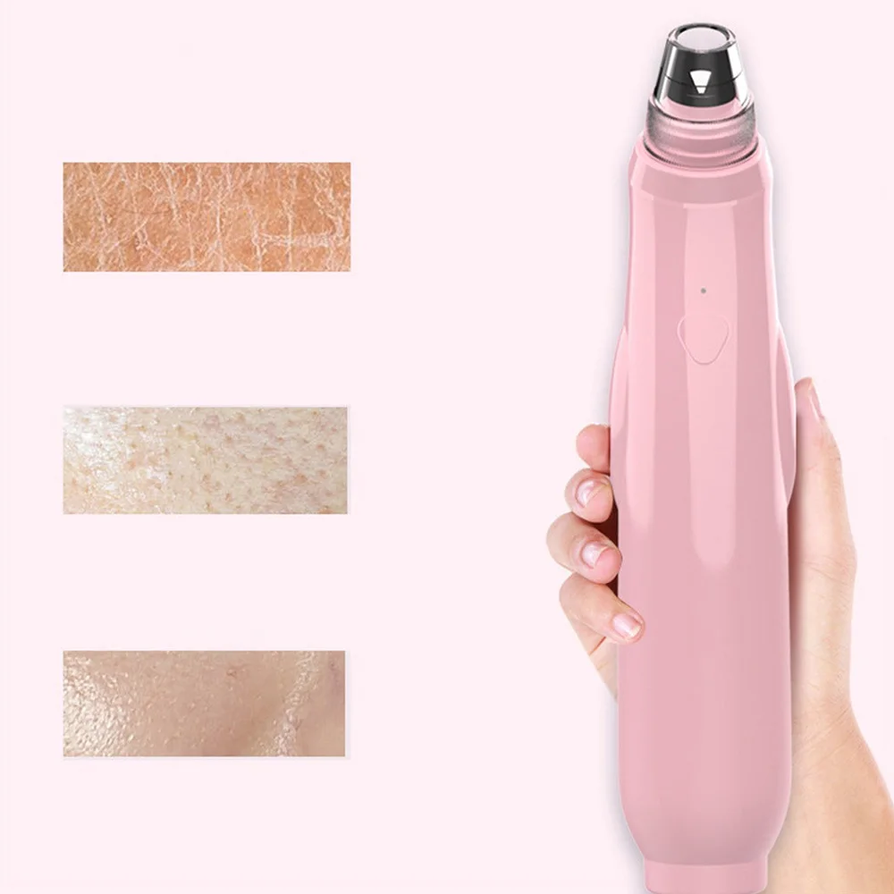 Средство для удаления черных точек средство глубокого очищения пор Удаление