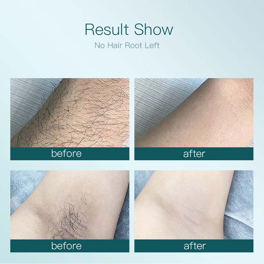 

Women Painless Hair Remover Machine IPL Laser Depilator 900000 Flash Professional Permanent LCD Laser Hair Removal Photoepilator