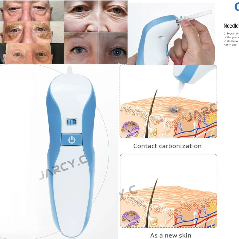 Плазменная ручка Maglev профессиональная машинка для ухода за кожей лица с 3 иглами |