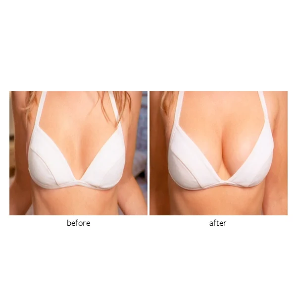 Новейшая модель Freezeframe без хирургического вмешательства груди увеличитель бюста