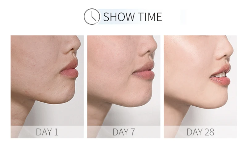 Отбеливающая лицевая сыворотка LAIKOU Sakura Essence Антивозрастная Гиалуроновая кислота