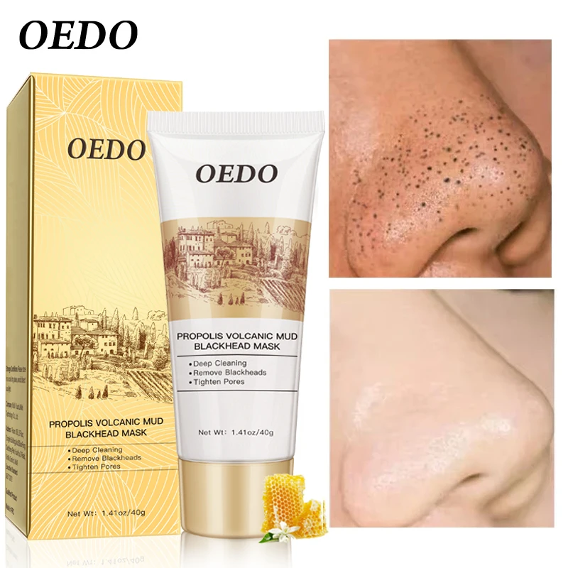 Вулканическая маска для лица OEDO 100 шт./лот удаления угрей клещей прополиса