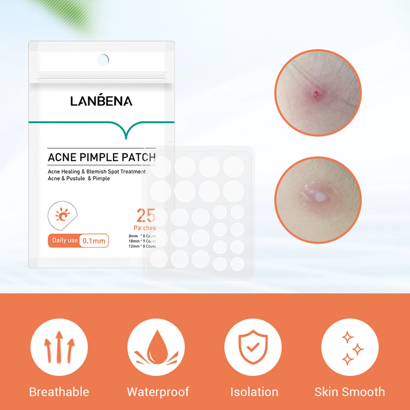 LANBENA Waterproof Day Use Acne Sticker Pimple Remover Patch Skin Care Treatment