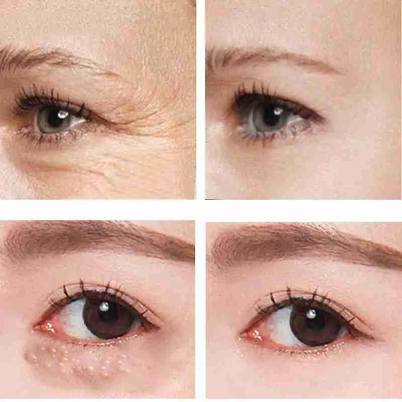 Крем для области вокруг глаз от Тёмных кругов и морщин 30 мл |