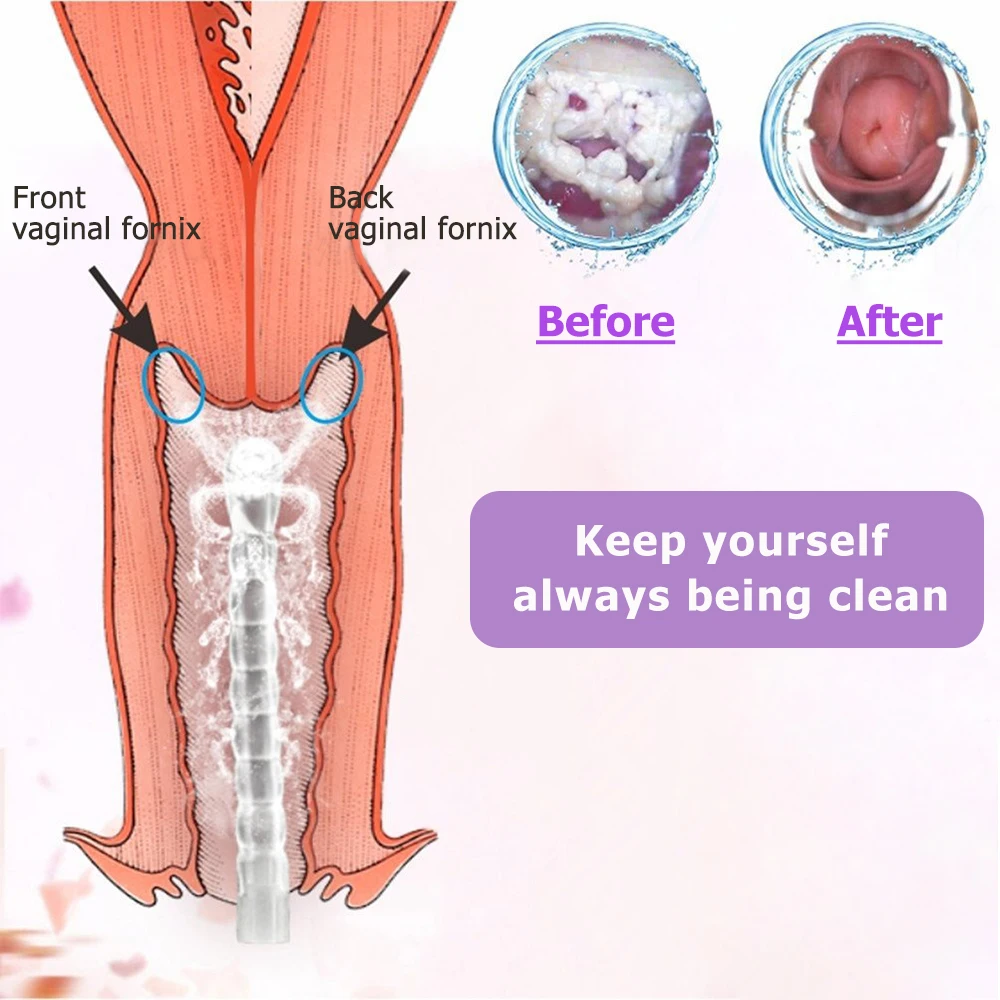 

Handheld Home Sprayer Bidet Portable Accurate Baby Washing Pregnant Self-Cleaning Nozzle Fresh Water Bidet Sprayer Large Capacit