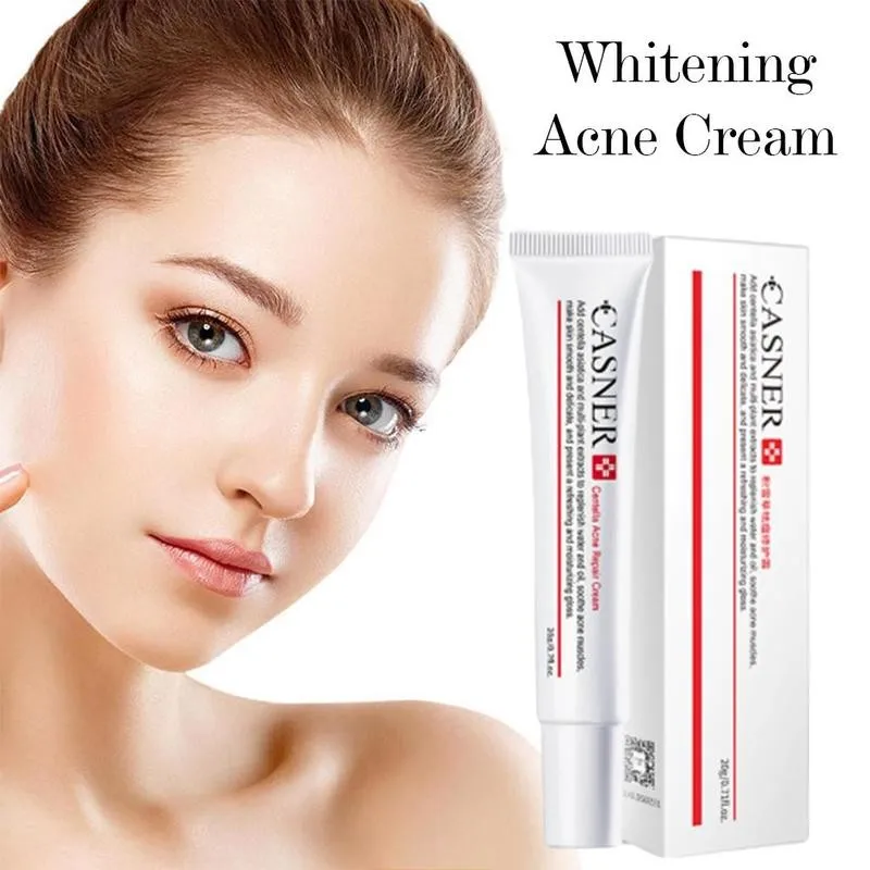20 мл Крем для удаления пятен лечение акне прыщи шрамы Mark укрепляющий крем ухода