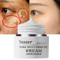 yoxier anti freckle whitening face cream remove melasma spot dark spots pigmentation moisturizing nourishing brighten skin care
