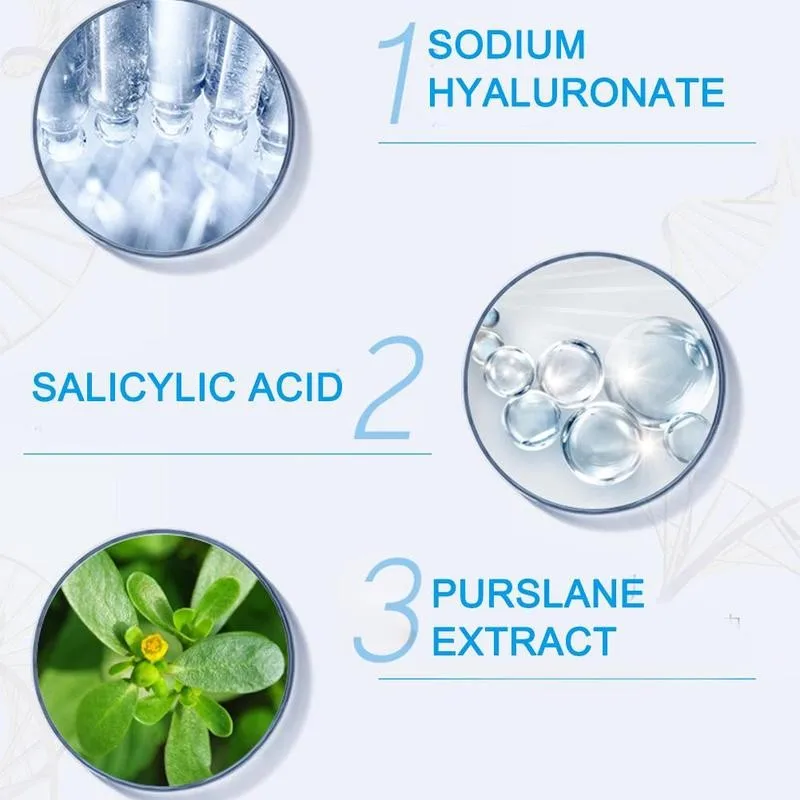 30g Acne Treatment Face Cream Blackhead Repair Gel Removal Whitening Acne Care Skin Pores Scar Cream Shrink W5G2