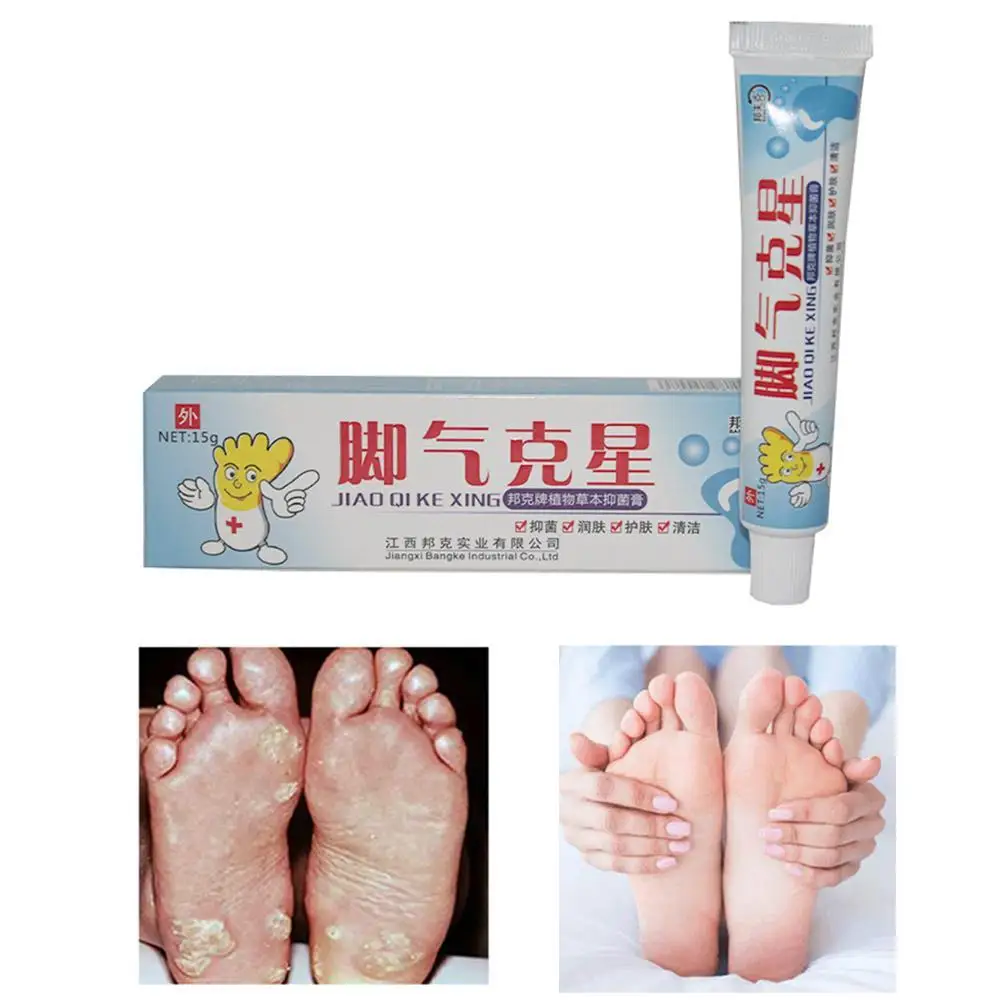Foot Cream Foots Corn Removal Athlete Erosive Beriberi Anti Itching Sweat Odor Feet Ointment Psoriasis Feets Antibacterial | Красота и