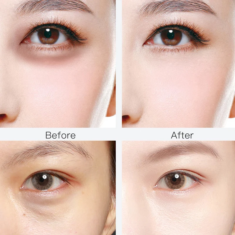 60pcs Dragon Blood Nicotinamide Repair Eye Patches Remove Dark Circles Moisturizing Mask Crystal Collagen Gel Skin Care |