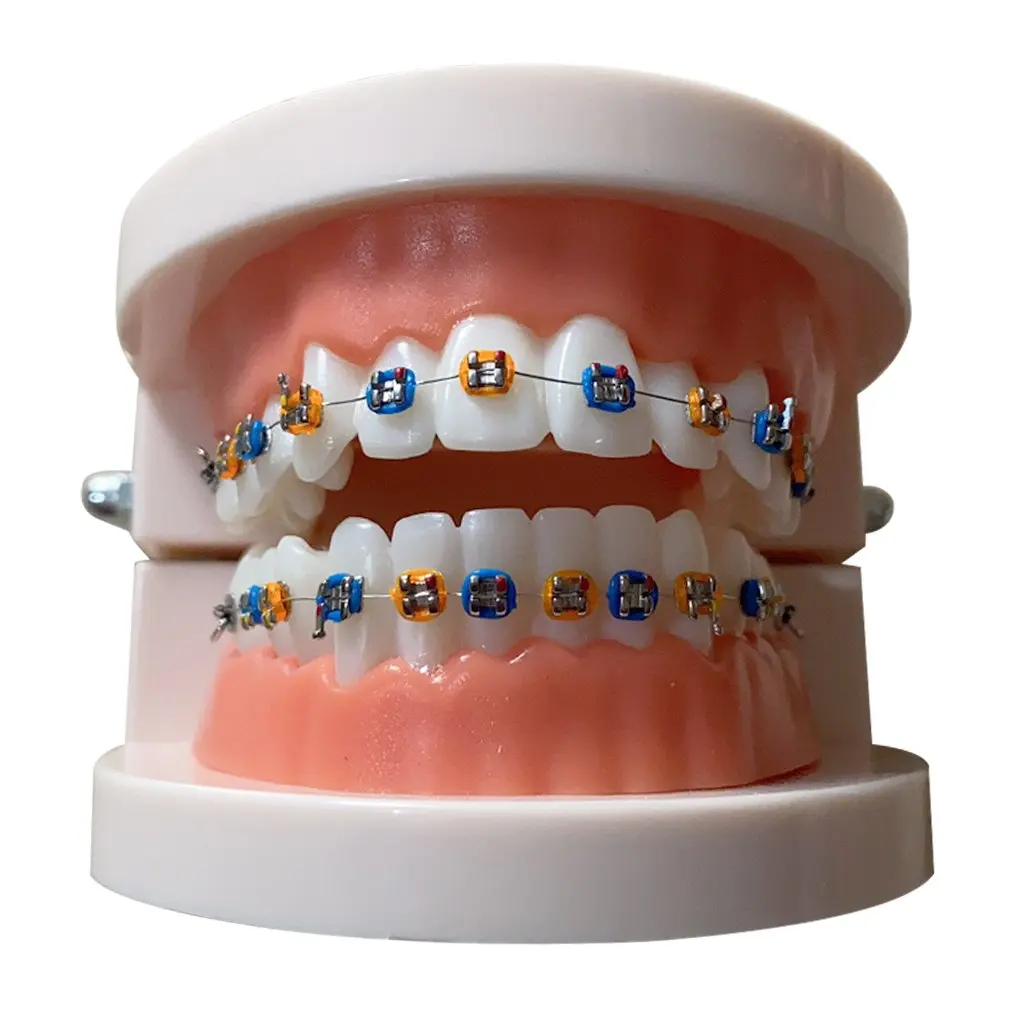 

Universal Portable Tooth Model Dental Materials Orthodontic Model Dental Equipment Metal Brackets Orthodontic Model