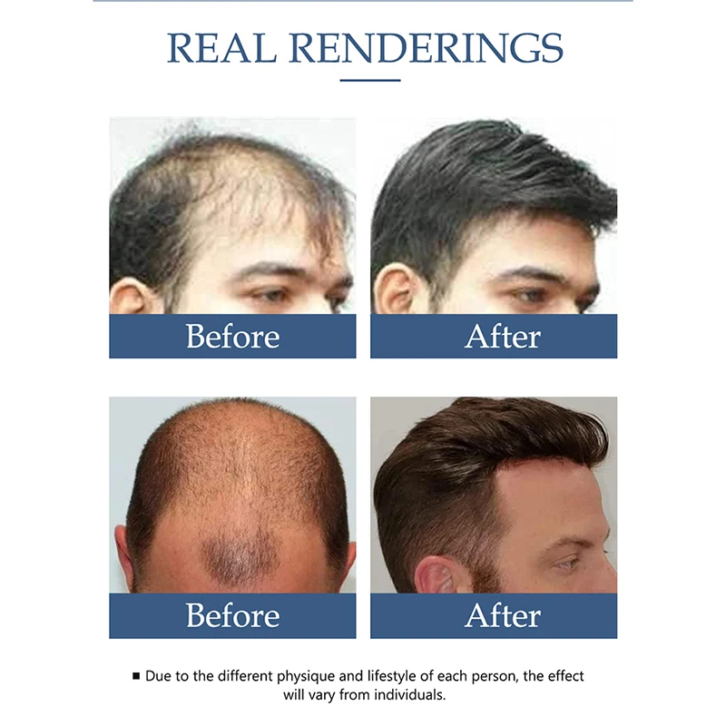 Сыворотка против выпадения волос эфирное масло жидкость для роста питательная