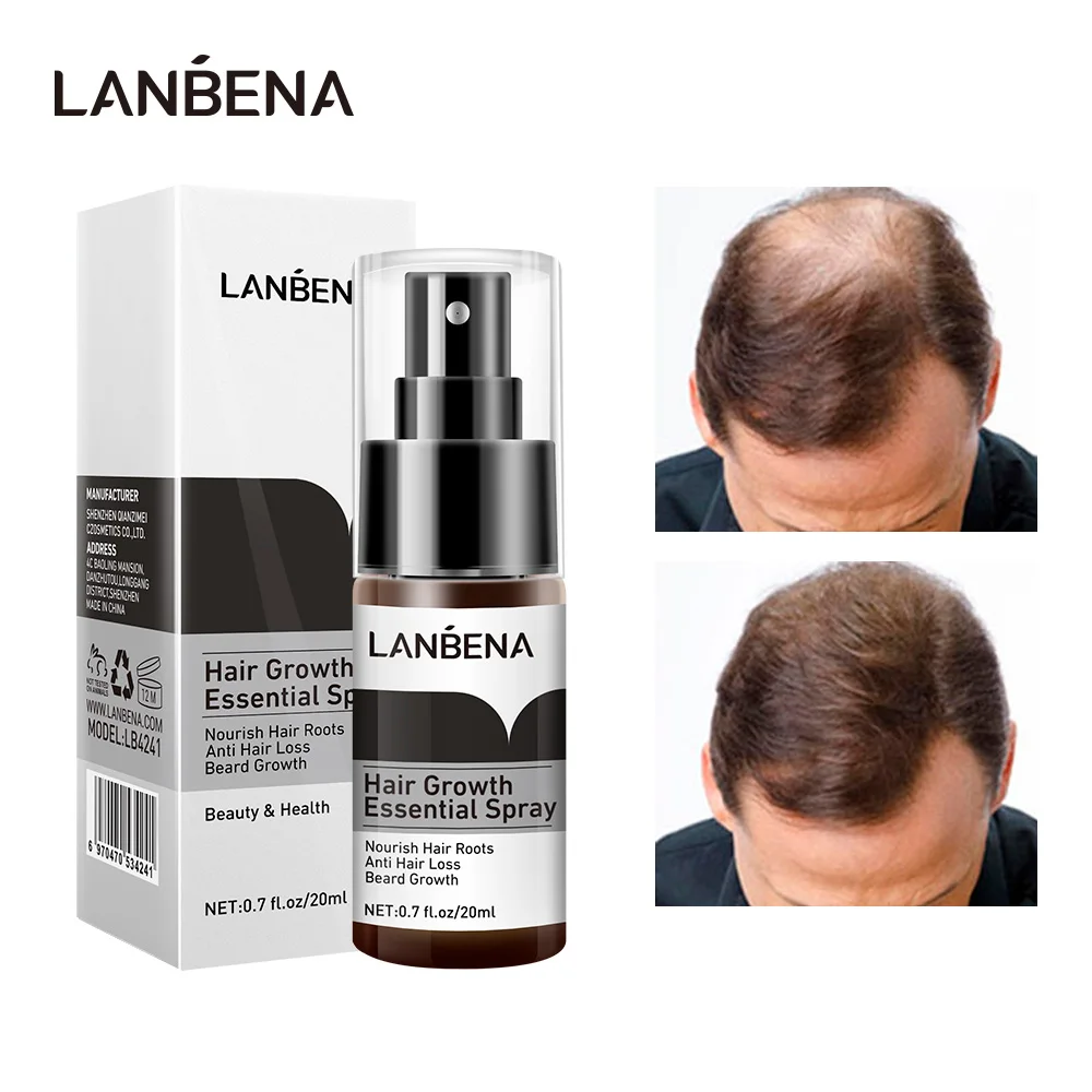 Средство для спрея LANBENA средство против облысения и выпадения волос питает корни
