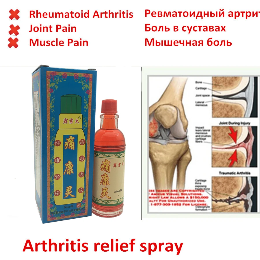 2/6/10 бутылка китайская травяная медицинская мазь от боли в суставах бальзам