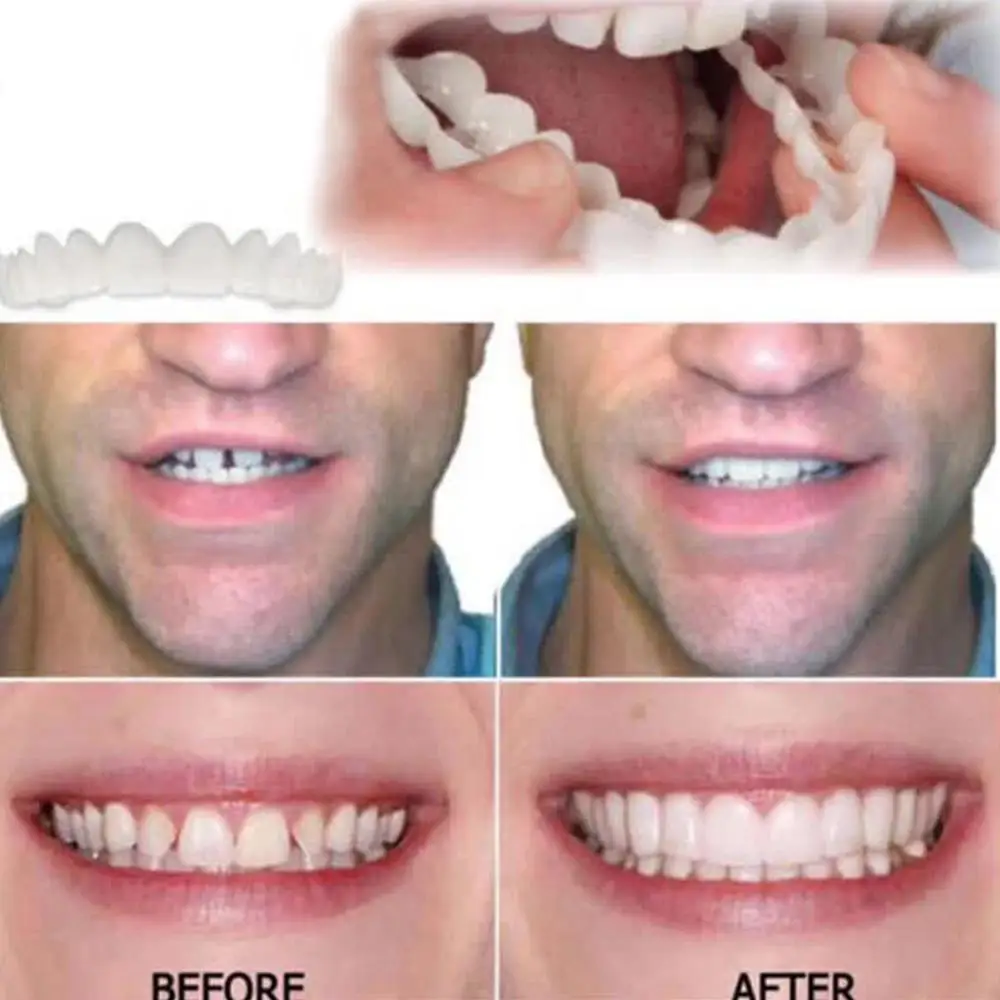 

Upper False Fake Tooth Cover Snap On Immediate Smile Cosmetic Denture Care Beauty Tool
