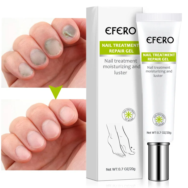 

EFERO Anti Fungal Nail Repair Gel Treatment Anti Infection Serum Onychomycosis Toe Nail Fungus Remover Nourish Essence Nail Care