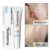 nuobisong acne marks removal cream face pimples scar stretch marks removal acne gel face skin care whitening moisturizing cream